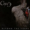 Cayne - Beyond The Scars